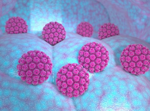 Virus del papiloma humano ginecólogo en monterrey
