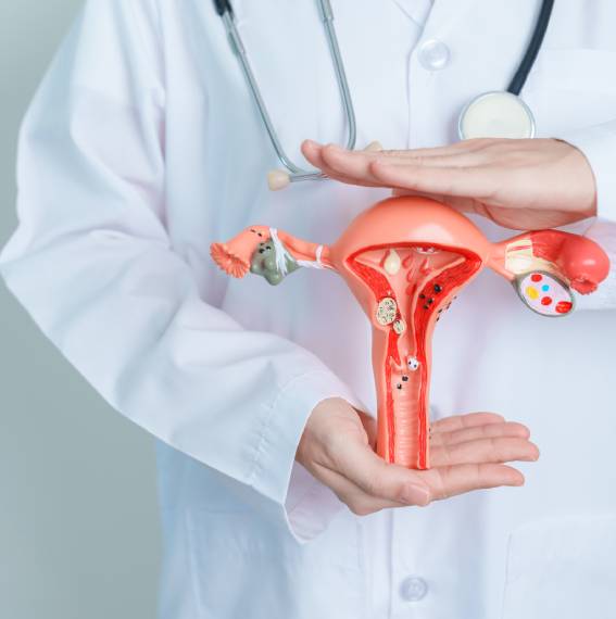 Endometriosis tratamiento Monterrey