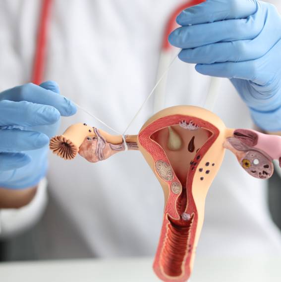 Menopausia tratamiento en Monterrey